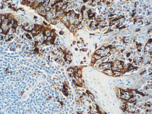 IHC of Lysozyme on a FFPE Tonsil Tissue